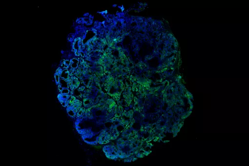 Células madre tumorales, en verde (G. Turon, IRB Barcelona)