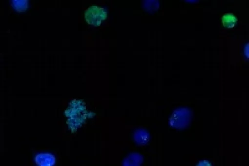 Centromeres (pictured) play a critical role in chromosome segregation and cell proliferation. their function is determined epigenetically by a variation of the histone H3. Image by Olga Moreno, IRB Barcelona