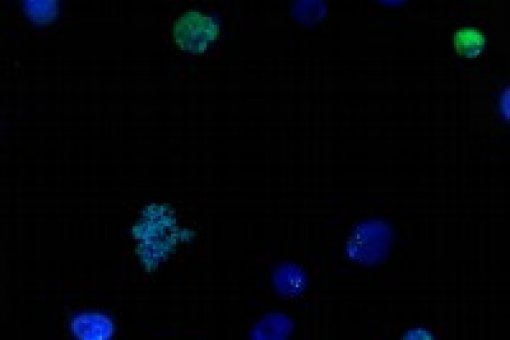 Los centrómeros (en la imagen) son esenciales durante la segregación de cromosomas y la proliferación celular. su función viene determinada epigenéticamente por una variante de la histona H3. Imagen de Olga Moreno, IRB Barcelona