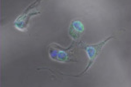 Macrophages digesting cellular remains © A Celada's group. IRB Barcelona