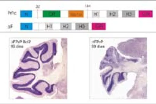 PrPc endógena(a dalt) PrPc truncada(a sota) Cerebel del triple transgenic(esquerra) Cerebel del transgènic, sense bcl-2(dreta)