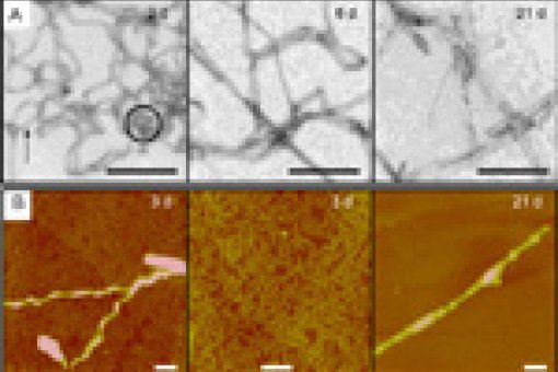 Different stages during the process of amyloid fibril formation<br /> (A)Electron microscope images after 2, 6 and 21 days of aggregation <br />(B)Atomic force microscope images after 3 and 21 days of aggregation