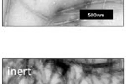 Although these two types of fibers are formed by the same protein, the ones above are toxic and the ones below are not.