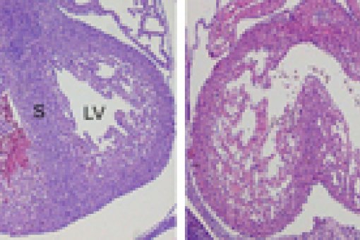 Functional myocardium (S) from a normal mouse embryo (left). The absence of p38&#945. and p38&#946. proteins produces myocardium lacking the heart septal (right).