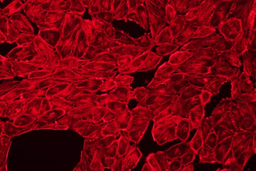 In black, gaps between blood vessel cells caused by signalling from tumour cells. Tumour cells cross these gaps in order to colonize the lung. (Microscope image: J Urosevic, IRB)