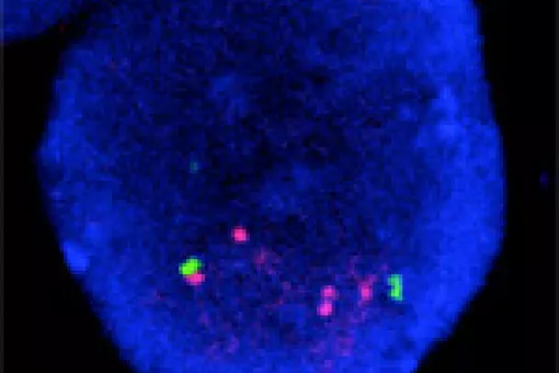 Image of a tumour cells with multiple copies of the Her2 gene shown in red. © IRB Barcelona. R. Gomis