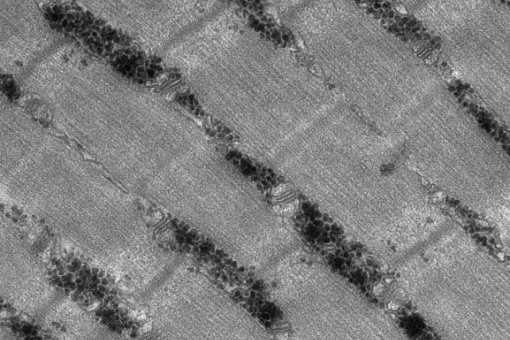 El glucógeno (gránulos negros en la imagen) se acumula en exceso en el músculo de ratones por la ausencia de la proteína glucogenina (Giorgia Testoni, IRB Barcelona)