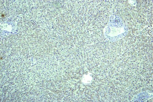 Tissue sample from healthy human liver (IRBBarcelona/IDIBAPS)