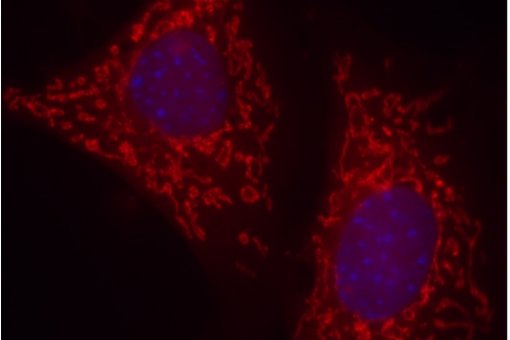 Tumor cells form mouse in lab cultures