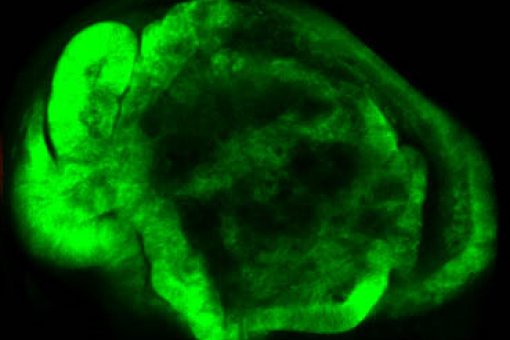 La sobre-expressió del gen Serpent en l’ala de Drosophila provoca un sobrecreixement permanent i és suficient per induir tumors (Imatge: Kyra Campbell, IRB Barcelona)