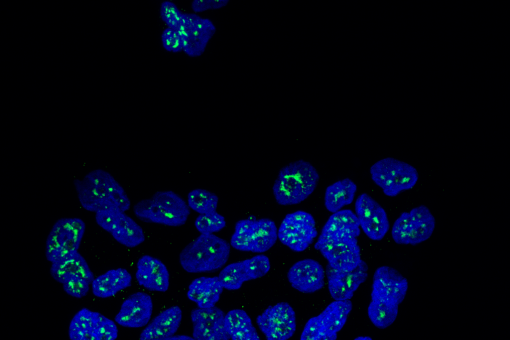 Nuclis de cèl·lules metastàtiques de càncer de mama amb la proteïna MSK1 en verd (Autor: Cristina Figueras-Puig, IRB Barcelona)