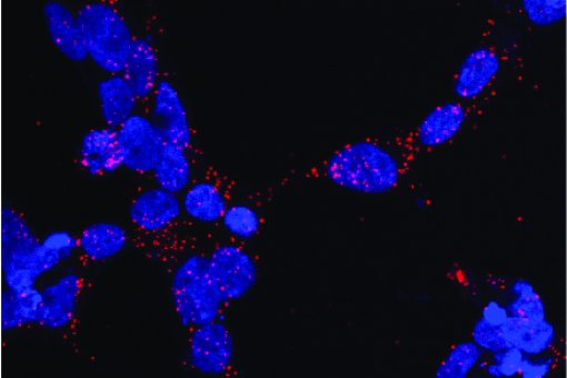 Interacción en las células entre el receptor de andrógenos y la chaperona Hsp70 (en rojo). En azul se muestran los núcleos de las células. Xavier Salvatella, IRB Barcelona.