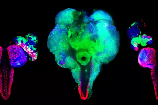 Capacidad de proliferación e invasión de las células tumorales (centro) en comparación con células normales (izquierda) y efecto del tratamiento con TRAMETINIB reduciendo la carga invasiva y tumoral (derecha). Marco Milán, IRB Barcelona.
