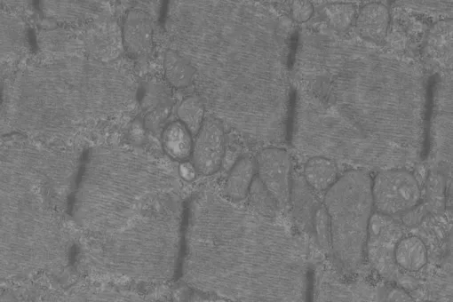 Acumulación patológica de mitocondrias en músculo esquelético de ratón deficiente de OPA1. Aida Rodríguez, IRB Barcelona