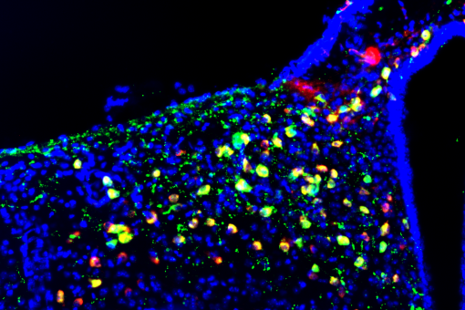 Imagen de microscopía de fluorescencia del núcleo arcuado del hipotálamo donde se aprecian, en color verde, las neuronas POMC (Imagen  Alicia G Gómez-Valadés).