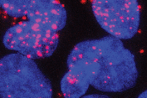 The image shows interactions between the androgen receptor protein (AR) and the TFIIF protein in red. (Author: Paula Martínez-Cristóbal)
