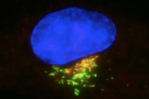 Imagen de microscopía de una célula humana que muestra la proteína VPS13B (rojo) en el Golgi (verde), junto al núcleo (azul). Imagen: laboratorio de Organización de Microtúbulos.