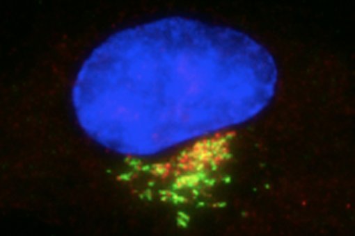 Imagen de microscopía de una célula humana que muestra la proteína VPS13B (rojo) en el Golgi (verde), junto al núcleo (azul). Imagen: laboratorio de Organización de Microtúbulos.