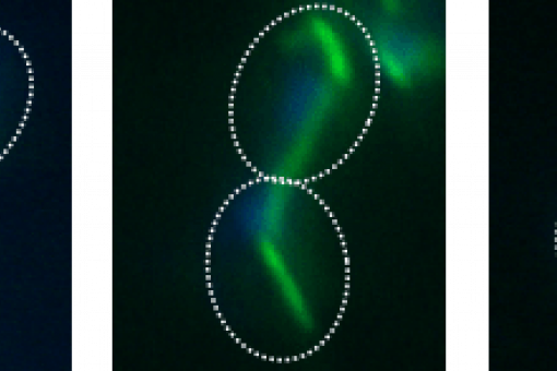 Cells of the yeast Saccharomyces cerevisiae in  the mitosis phase of the cell cycle
