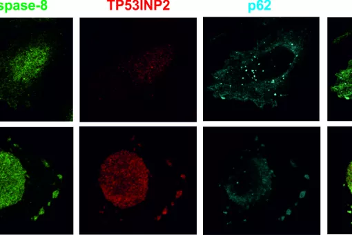 Diferentes localizaciones de las proteínas involucradas en apoptosis en condiciones basales (Ctrl) y con inducción de los receptores de muerte celular con TRAIL. Saška Ivanova, IRB Barcelona