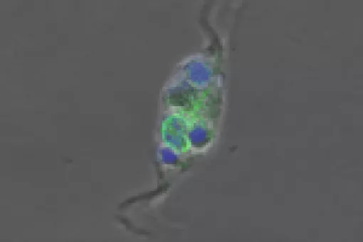 Macrophages are key cells in the immune system. Among other functions, they remove debris, pathogens or foreign agents from our body. In the image, a macrophage (with nucleus in green) has swallowed fragments of dead cells (in blue)(c) Maria Serra