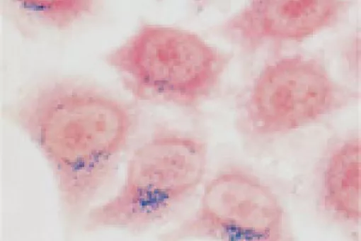 Cells with magnetic nanoparticles inside (in blue)