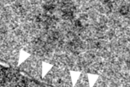 La proteína MEL-28 permite que la célula dividida conserve una estructura nuclear adecuada.<br />