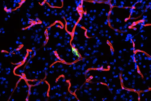 A cancer cell (green) crosses a blood vessel (red) to enter to the brain tissue. Author: Dr. Manuel Valiente