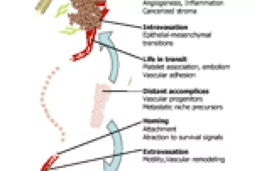 Stages of metastatic progression (zoom). (c) Joan Massagué - MSKCC, IRB Barcelona