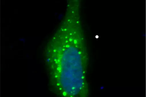 "Gotas líquidas " de CPEB4en el citoplasma celular (J. Guillén-Boixet, IRB Barcelona)