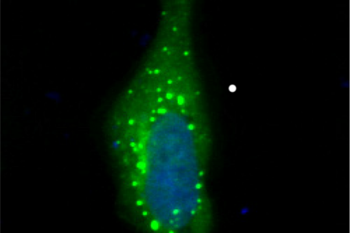"Gotes líquides" de CPEB4 en el citoplasma cel·lular (J. Guillén-Boixet, IRB Barcelona)