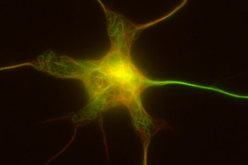 Microscopy image of a culture mouse neuron showing the microtubule network in green and red depending on chemical modifications. The axon, in bright green, is the neuronal extension that has the greatest number of modified microtubules (Author: Carlos Sán