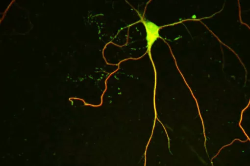 La imagen muestra una neurona cultivada teñida con anticuerpos que etiquetan microtúbulos. NEK7 promueve la estabilidad de los microtúbulos dendríticos, importante para el crecimiento y la ramificación adecuada de las dendritas (F. Freixo, IRB Barcelona)