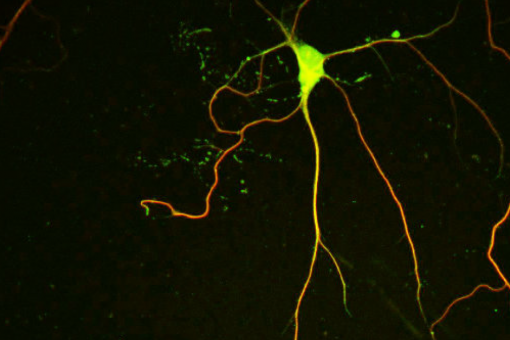 La imatge mostra una neurona cultivada tenyida amb anticossos que etiqueten microtúbuls. NEK7 promou l'estabilitat dels microtúbuls dendrítics, important per al creixement i la ramificació adequada de les dendrites (F. Freixo, IRB Barcelona)