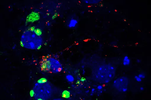 Neurons accumulate glycogen in small amounts, which is beneficial for them.  Glycogen synthase (in green) and glycogen accumulation in red (Author:  Isabel Sáez, IRB)