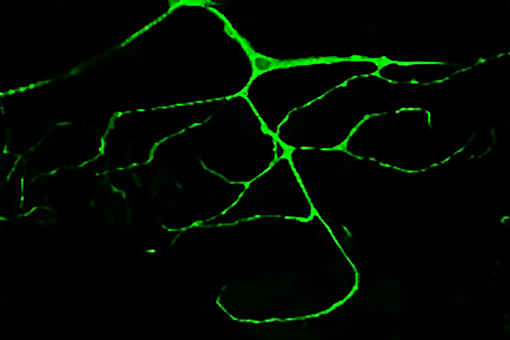 Highly ramificated tracheal cell of a Drosophila larvae marked with GFP. (Delia Ricolo)