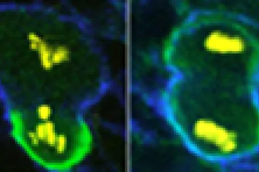 (c)EMBL. Left: Normal dividing neuroblasts create a large new cell and a smaller cell destined to become part of a nerve. Right: If molecules aren't put in the right places, this asymmetric division doesn't occur and a tumor develops.