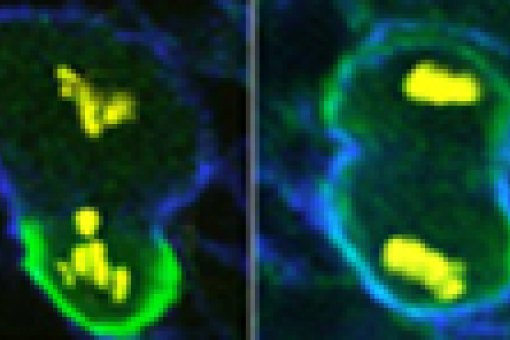 (c)EMBL. Left: Normal dividing neuroblasts create a large new cell and a smaller cell destined to become part of a nerve. Right: If molecules aren't put in the right places, this asymmetric division doesn't occur and a tumor develops.