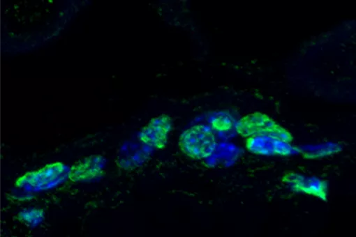 Acumulación de daño en el ADN de la piel de ratón envejecido (Guiomar Solanas y Francisca Peixoto, IRB Barcelona)