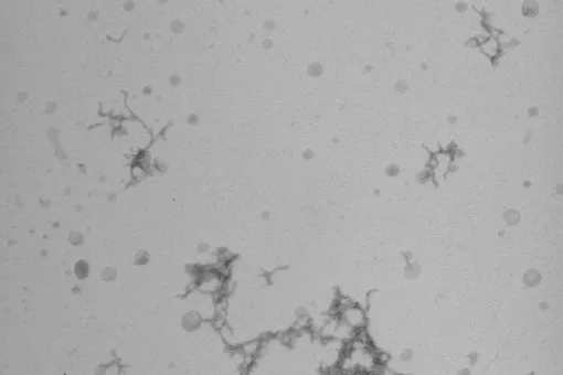 El equipo de Natàlia Carulla estudia las asociaciones de beta-amiloide . En la imagen de microscopía se observan cúmulos de beta-amiloide en muestras in vitro. (Bernat Serra-Vidal, IRB Barcelona)