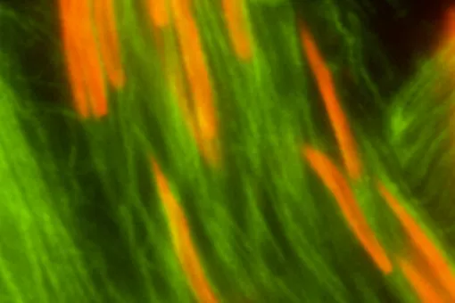  Espermatozoides de Drosophila melanogaster mutante. Las cabezas han perdido la unión con el final de las colas y están desperdigadas. Foto cortesía de S. Llamazares / Gonzalez Lab 