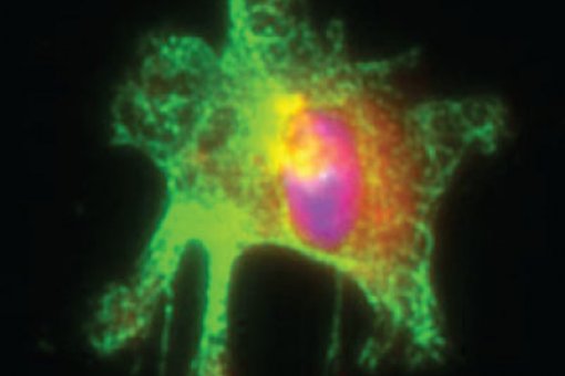 Activated macrophage isolated from mouse intestine. Macrophage marker is shown in green, inflammation marker (iNOS) in red, and nucleus in blue. Author: Catrin Youssif, IRB Barcelona
