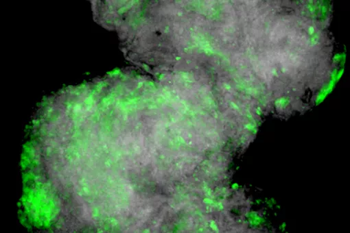 Epithelial tumor (in grey), expressing the Matrix Metalloproteinase MMP1, that helps degradate the membrane (in green)  © M. Milán lab, IRB Barcelona. Author: Mariana Muzzopappa