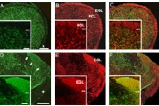 The progenitors of the ventricular zone of the cerebellum without Ptf1a produce granular cells. (c) IRB Barcelona.
