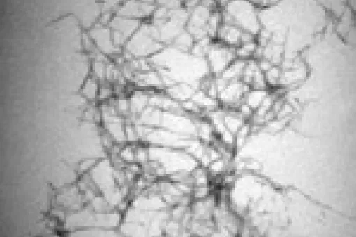 The infective action is produced by the prion PrP106-126
