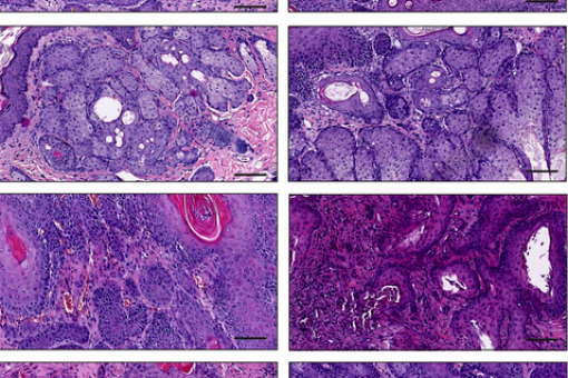 Imatges representatives de diferents subtipus de tumors de pell (L. Rinaldi, IRB Barcelona)