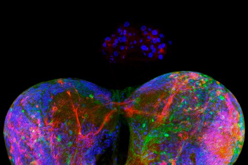 Glándula anular del cerebro de Drosophila, equivalente a la glándula protorácica humana, responsable de la producción de hormonas esteroideas.