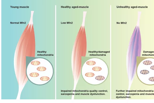 Esquema donde se muestra la relación entre diferentes niveles de expresión de Mitofusina 2 y envejecimiento muscular  (D. Sebastián, IRB Barcelona, CIBERDEM).