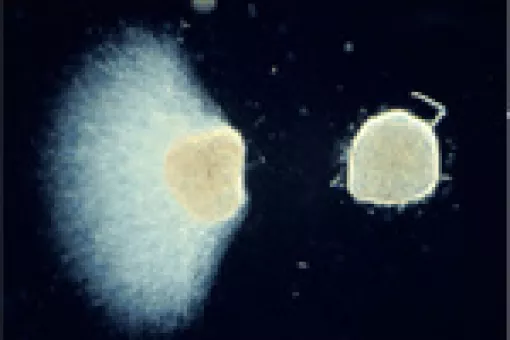 The image shows axon repulsion by semaphorin 3A. The molecule identified by researchers acts against Sema 3A.(c) E. Soriano, IRB Barcelona.