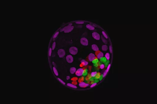 Plasticidad celular: identidades diferentes y reversibles (Cian J. Lynch, IRB Barcelona)